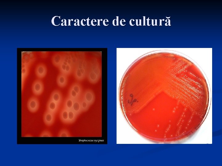 Caractere de cultură 