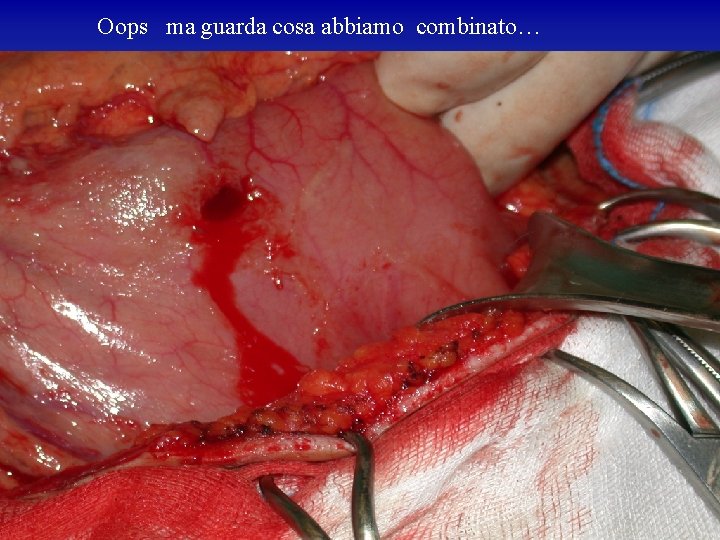 Oops ma guarda cosa abbiamo combinato… 