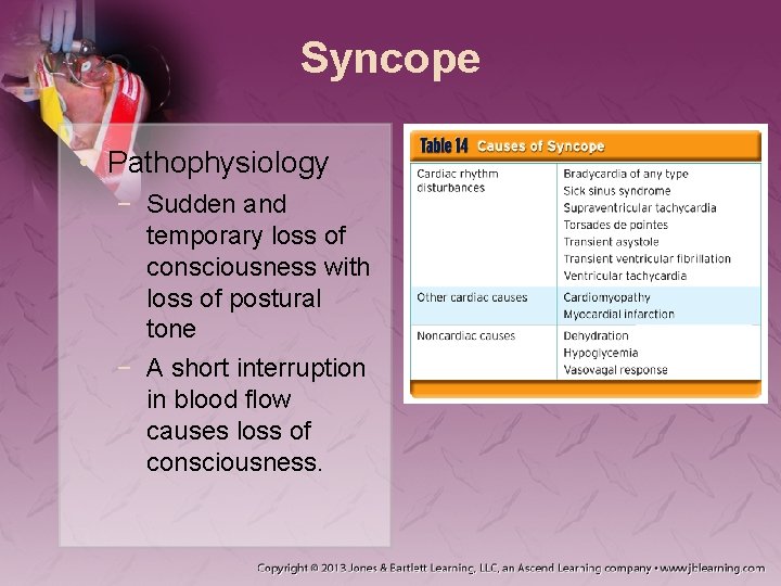 Syncope • Pathophysiology − Sudden and temporary loss of consciousness with loss of postural