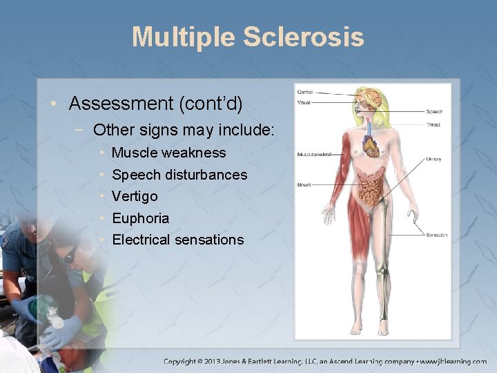 Multiple Sclerosis • Assessment (cont’d) − Other signs may include: • • • Muscle