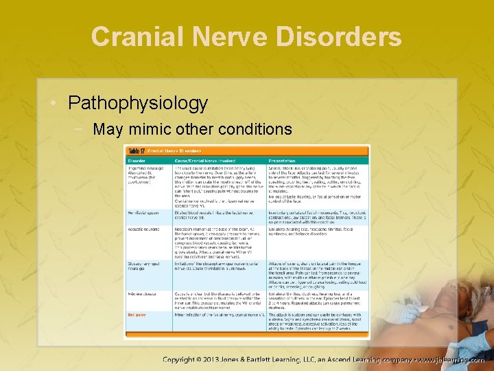 Cranial Nerve Disorders • Pathophysiology − May mimic other conditions 