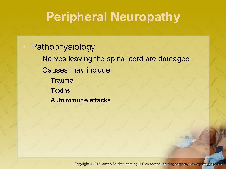 Peripheral Neuropathy • Pathophysiology − Nerves leaving the spinal cord are damaged. − Causes