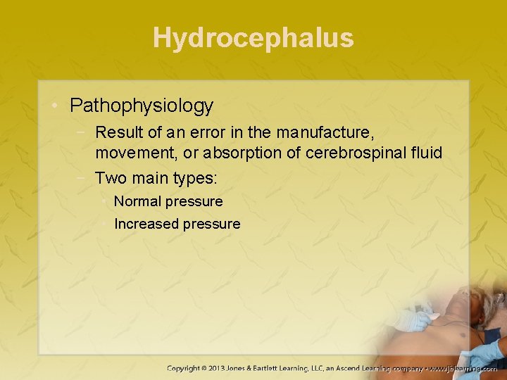 Hydrocephalus • Pathophysiology − Result of an error in the manufacture, movement, or absorption