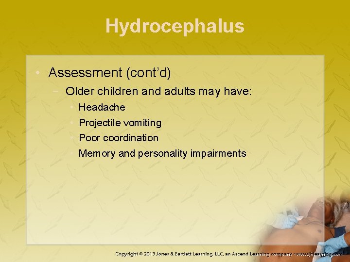 Hydrocephalus • Assessment (cont’d) − Older children and adults may have: • • Headache