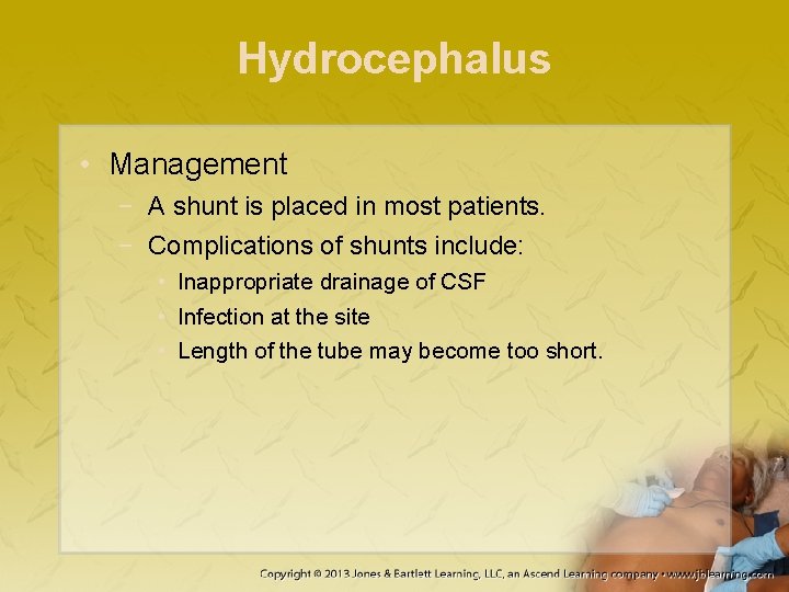 Hydrocephalus • Management − A shunt is placed in most patients. − Complications of