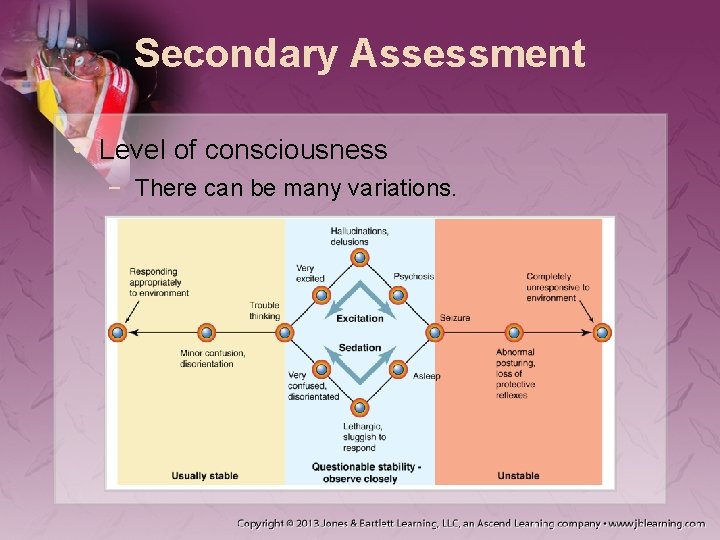 Secondary Assessment • Level of consciousness − There can be many variations. 