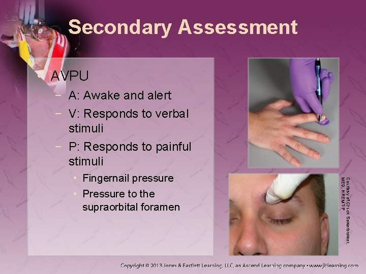 Secondary Assessment • AVPU − A: Awake and alert − V: Responds to verbal