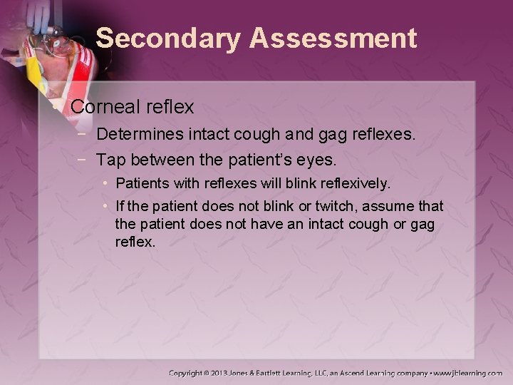 Secondary Assessment • Corneal reflex − Determines intact cough and gag reflexes. − Tap