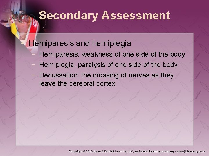Secondary Assessment • Hemiparesis and hemiplegia − Hemiparesis: weakness of one side of the