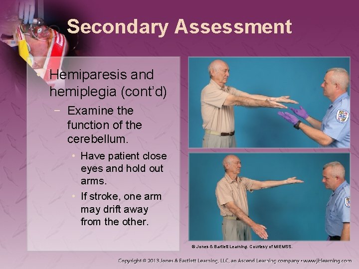 Secondary Assessment • Hemiparesis and hemiplegia (cont’d) − Examine the function of the cerebellum.