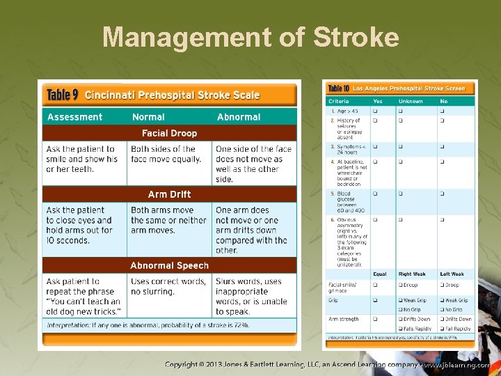 Management of Stroke 