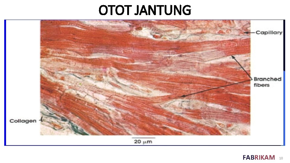 OTOT JANTUNG FABRIKAM 10 