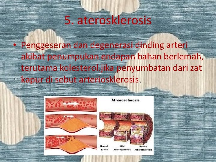 5. aterosklerosis • Penggeseran degenerasi dinding arteri akibat penumpukan endapan bahan berlemah, terutama kolesterol.