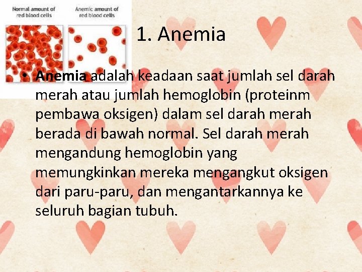 1. Anemia • Anemia adalah keadaan saat jumlah sel darah merah atau jumlah hemoglobin