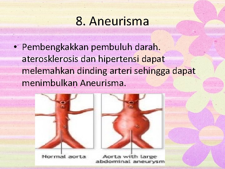 8. Aneurisma • Pembengkakkan pembuluh darah. aterosklerosis dan hipertensi dapat melemahkan dinding arteri sehingga