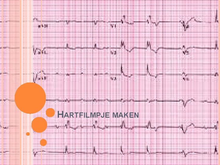 HARTFILMPJE MAKEN 