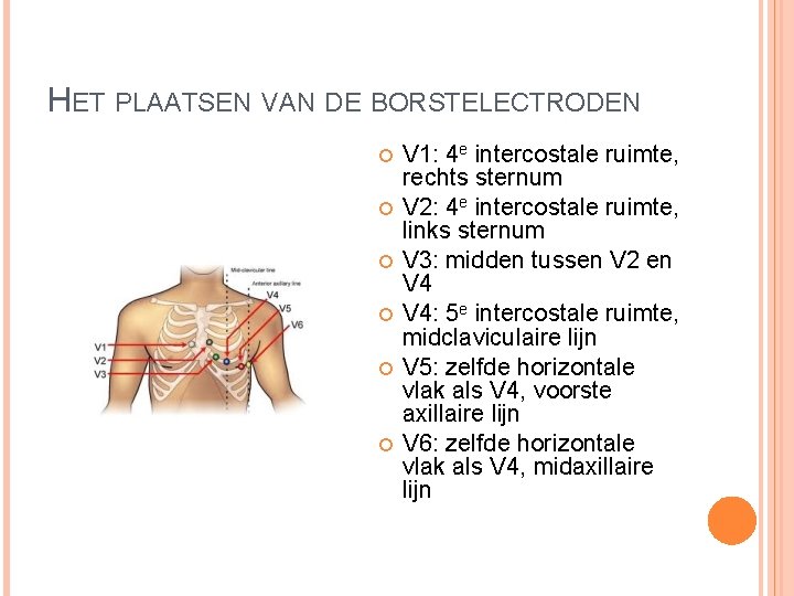 HET PLAATSEN VAN DE BORSTELECTRODEN V 1: 4 e intercostale ruimte, rechts sternum V