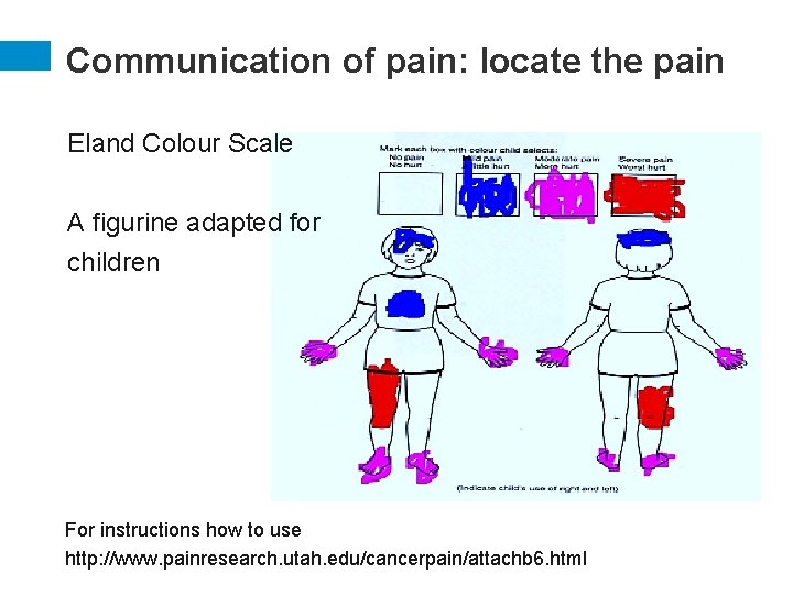 Communication of pain: locate the pain Eland Colour Scale A figurine adapted for children