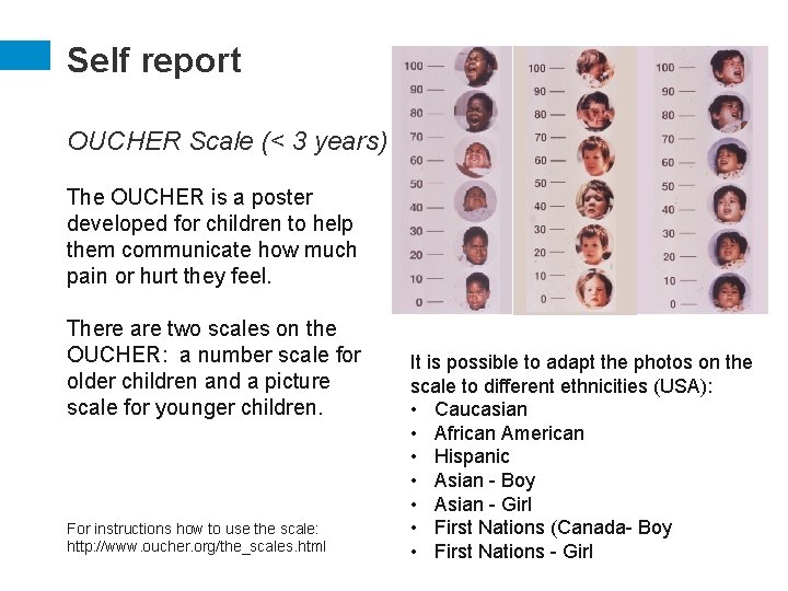 Self report OUCHER Scale (< 3 years) The OUCHER is a poster developed for