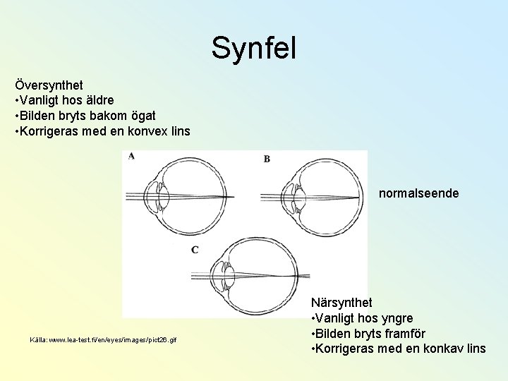 Synfel Översynthet • Vanligt hos äldre • Bilden bryts bakom ögat • Korrigeras med
