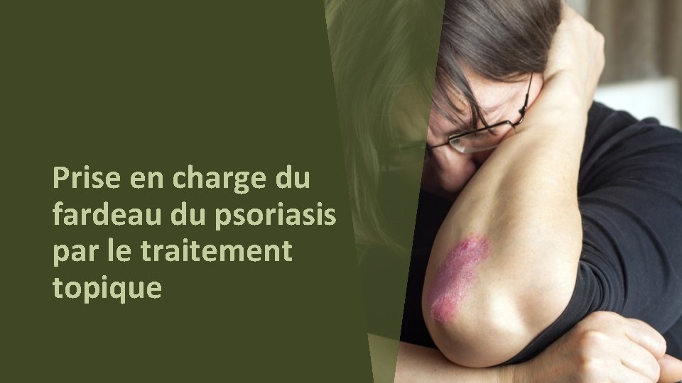 Prise en charge du fardeau du psoriasis par le traitement topique 