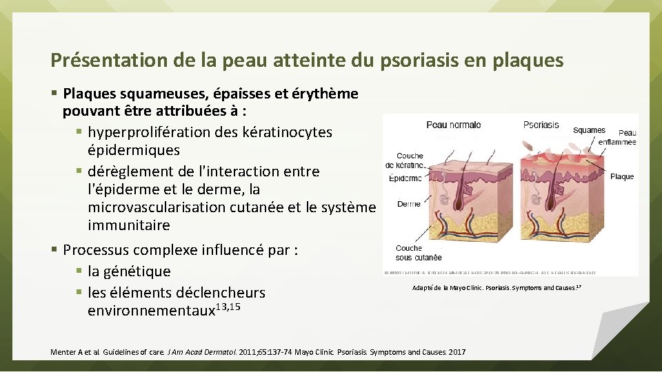 Présentation de la peau atteinte du psoriasis en plaques § Plaques squameuses, épaisses et