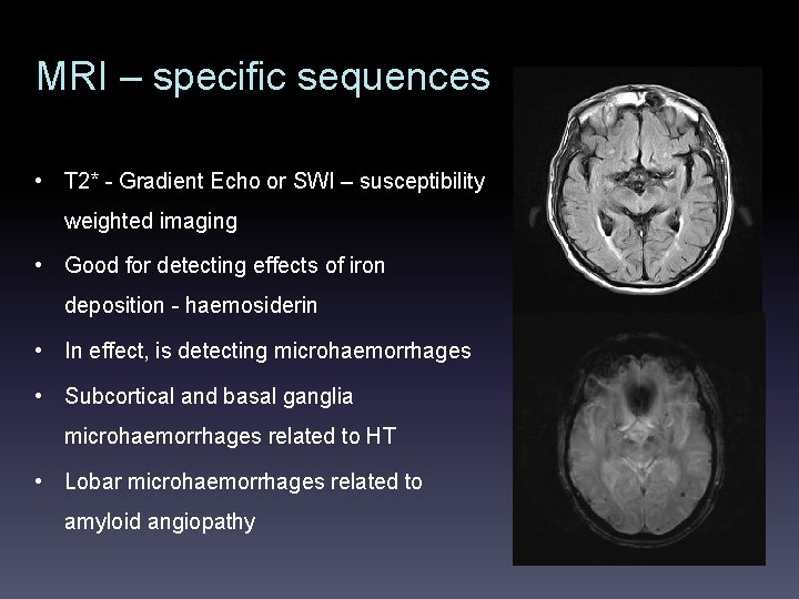 MRI – specific sequences • T 2* - Gradient Echo or SWI – susceptibility