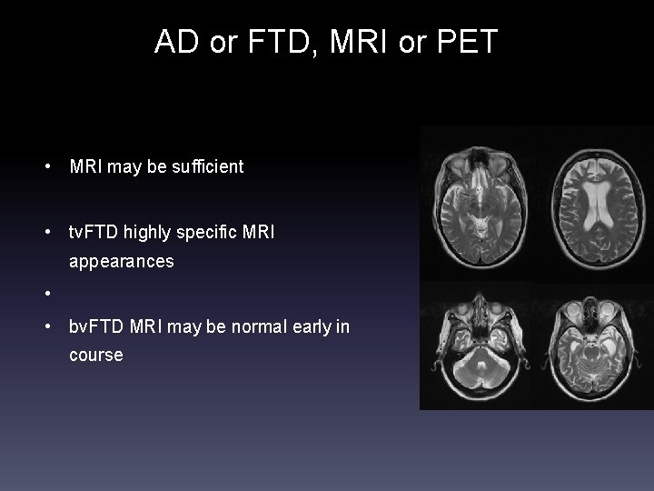 AD or FTD, MRI or PET • MRI may be sufficient • tv. FTD