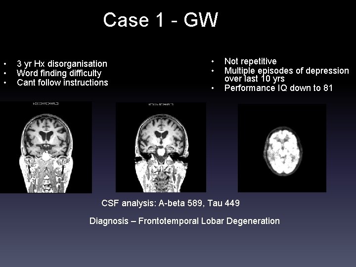 Case 1 - GW • • • 3 yr Hx disorganisation Word finding difficulty