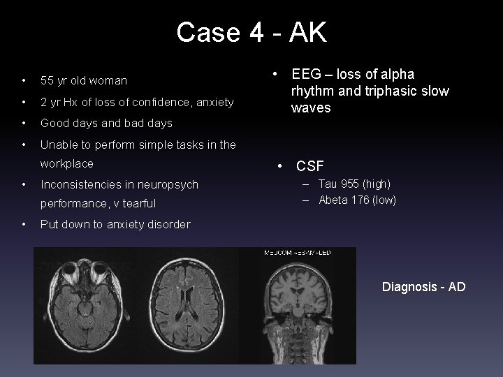 Case 4 - AK • 55 yr old woman • 2 yr Hx of