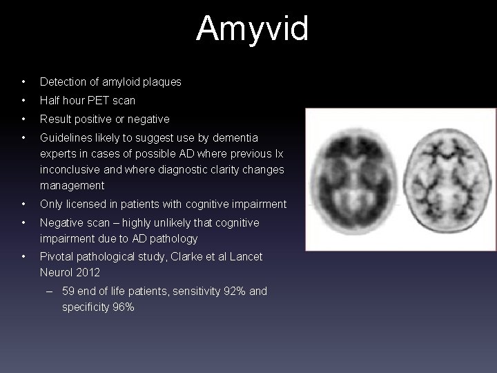 Amyvid • Detection of amyloid plaques • Half hour PET scan • Result positive
