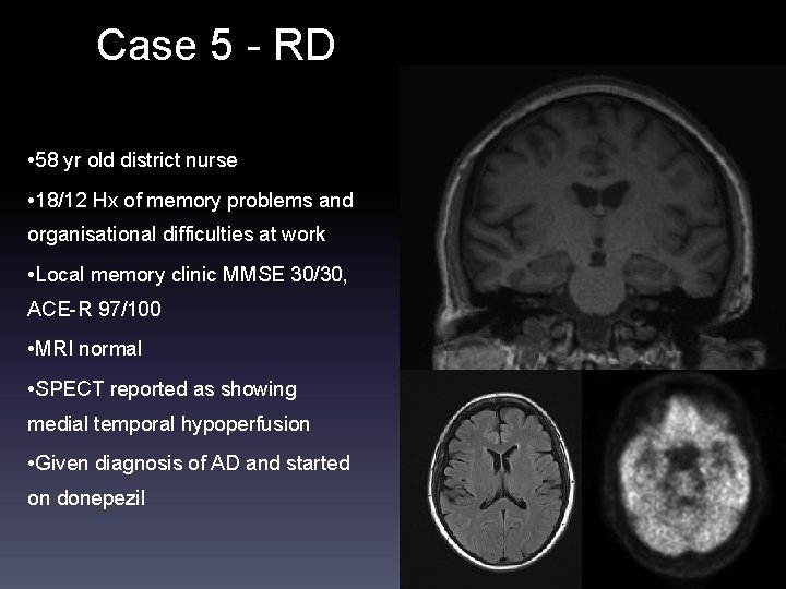 Case 5 - RD • 58 yr old district nurse • 18/12 Hx of