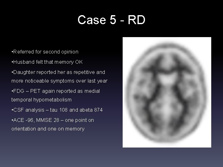 Case 5 - RD • Referred for second opinion • Husband felt that memory