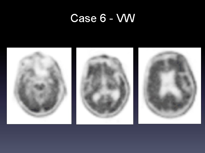 Case 6 - VW 