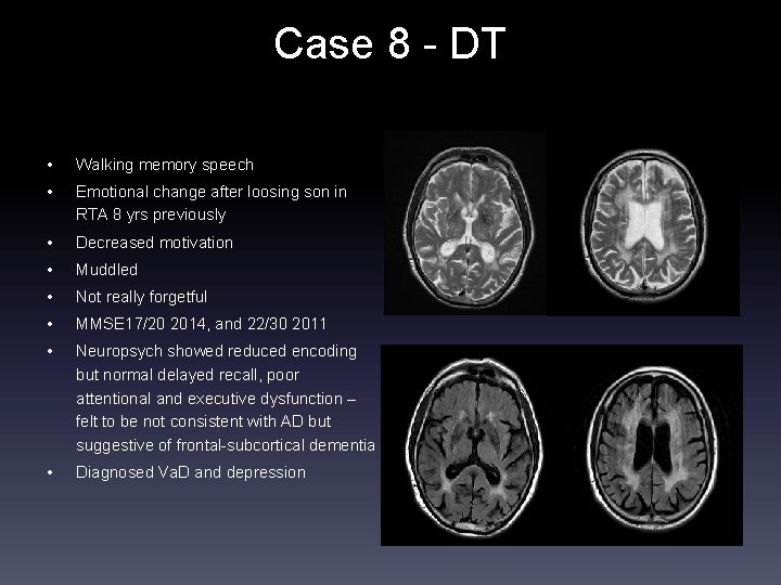 Case 8 - DT • Walking memory speech • Emotional change after loosing son