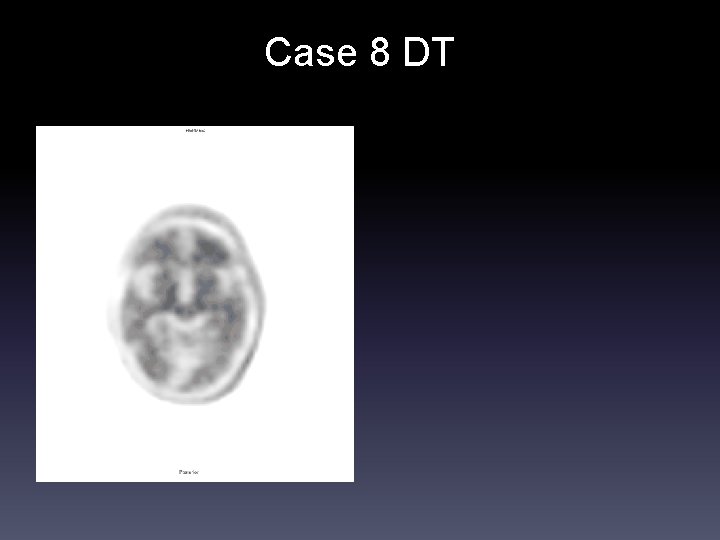 Case 8 DT 