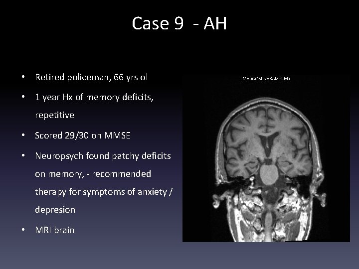 Case 9 - AH • Retired policeman, 66 yrs ol • 1 year Hx