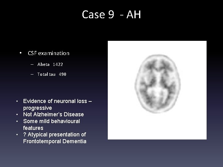 Case 9 - AH • CSF examination – Abeta 1422 – Total tau 490