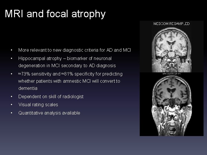 MRI and focal atrophy • More relevant to new diagnostic criteria for AD and