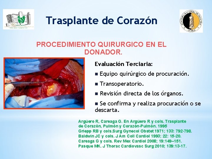 Trasplante de Corazón PROCEDIMIENTO QUIRURGICO EN EL DONADOR. Evaluación Terciaria: n Equipo quirúrgico de