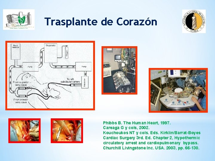 Trasplante de Corazón Phibbs B. The Human Heart, 1997. Careaga G y cols, 2002.