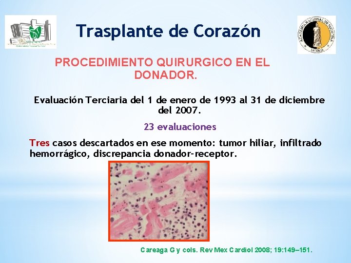 Trasplante de Corazón PROCEDIMIENTO QUIRURGICO EN EL DONADOR. Evaluación Terciaria del 1 de enero