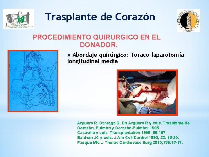 Trasplante de Corazón PROCEDIMIENTO QUIRURGICO EN EL DONADOR. Abordaje quirúrgico: Toraco-laparotomía longitudinal media n