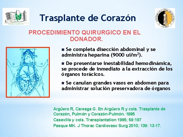 Trasplante de Corazón PROCEDIMIENTO QUIRURGICO EN EL DONADOR. Se completa disección abdominal y se