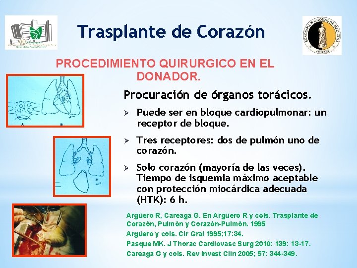 Trasplante de Corazón PROCEDIMIENTO QUIRURGICO EN EL DONADOR. Procuración de órganos torácicos. Ø Puede