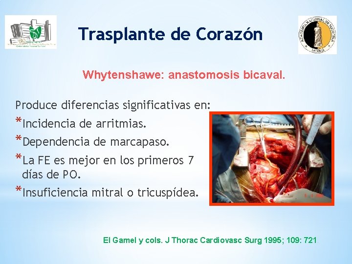Trasplante de Corazón Whytenshawe: anastomosis bicaval. Produce diferencias significativas en: *Incidencia de arritmias. *Dependencia