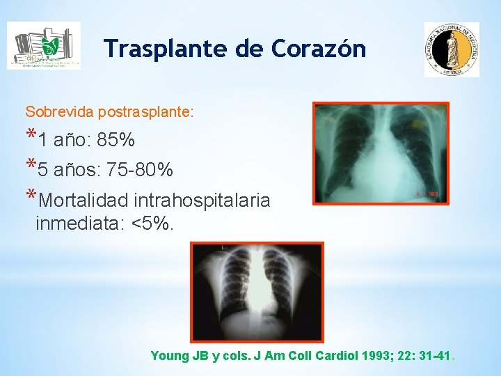 Trasplante de Corazón Sobrevida postrasplante: *1 año: 85% *5 años: 75 -80% *Mortalidad intrahospitalaria