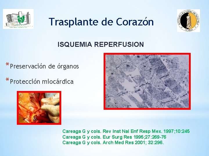Trasplante de Corazón ISQUEMIA REPERFUSION *Preservación de órganos *Protección miocárdica Careaga G y cols.