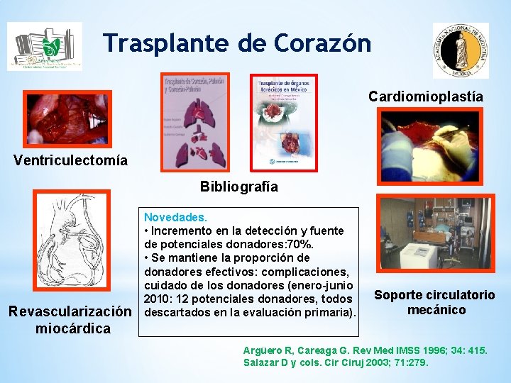 Trasplante de Corazón Cardiomioplastía Ventriculectomía Bibliografía Revascularización miocárdica Novedades. • Incremento en la detección