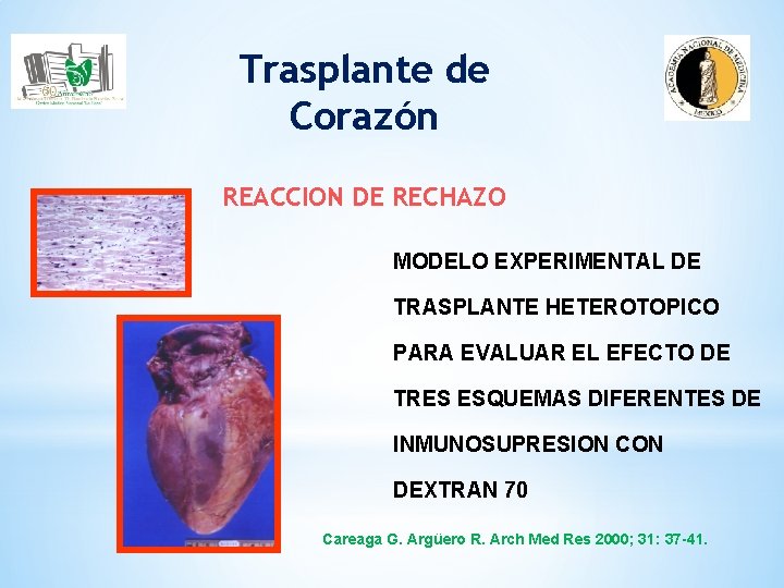 Trasplante de Corazón REACCION DE RECHAZO MODELO EXPERIMENTAL DE TRASPLANTE HETEROTOPICO PARA EVALUAR EL